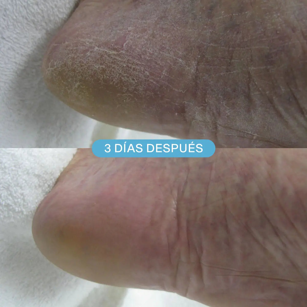 Espuma Hidratante DDCream (Doble Defensa)