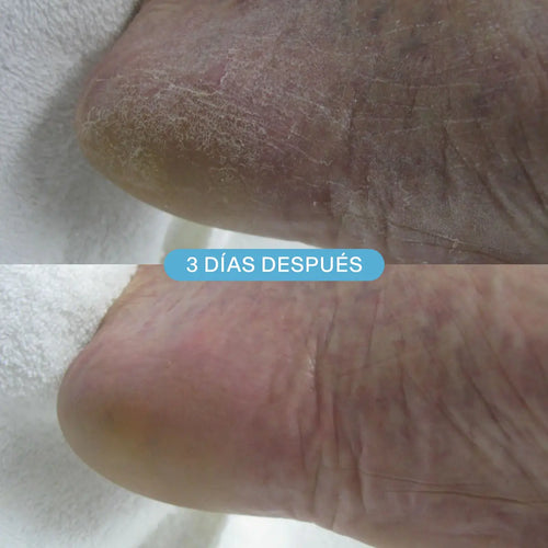 Espuma Hidratante DDCream (Doble Defensa)