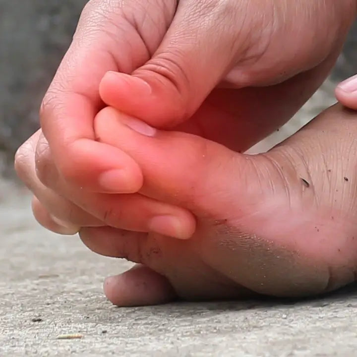 Dolor intenso y dificultad para caminar